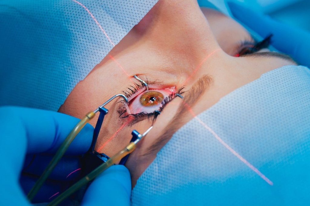 cirugía oftalmológica en Valencia - pinzas