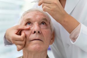 médico para cataratas en Valencia - gotas